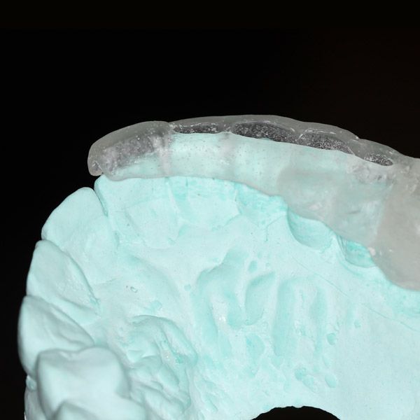 Dental surgery guide