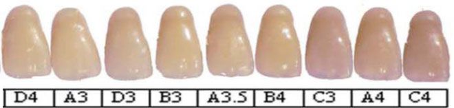 Photo of a shade guide